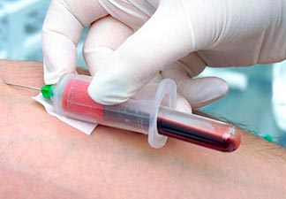 exame de sangue disgnóstico