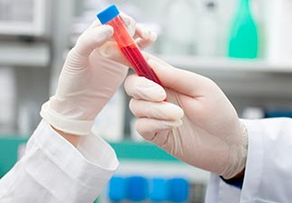 exames laboratoriais de sangue